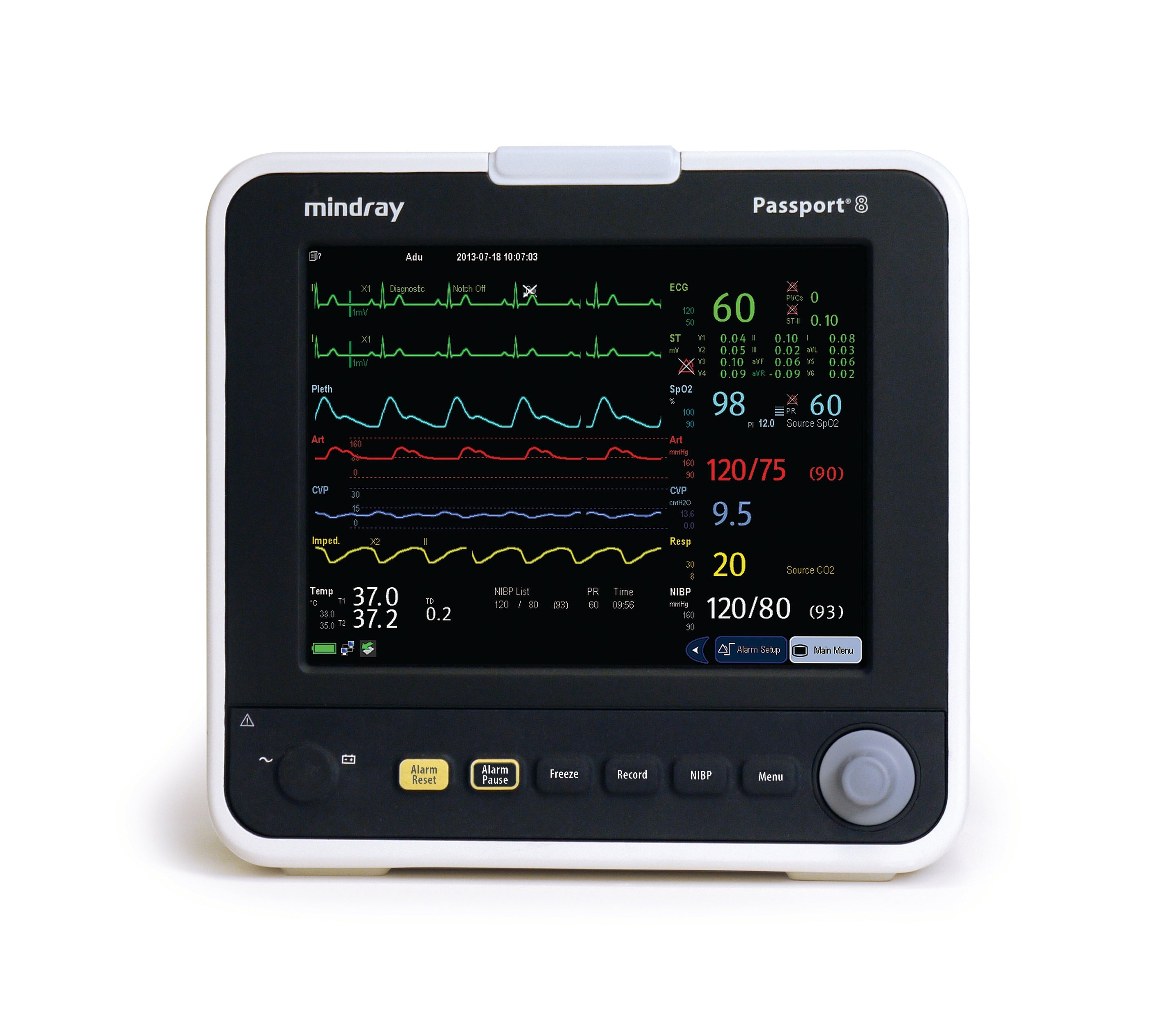 Mindray Passport 8 Patient Monitor