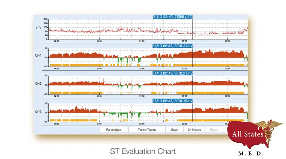 Edan SE 2003 / 2012 Holter monitor