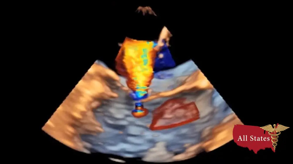 GE Vivid IQ Ultra Edition Portable Ultrasound