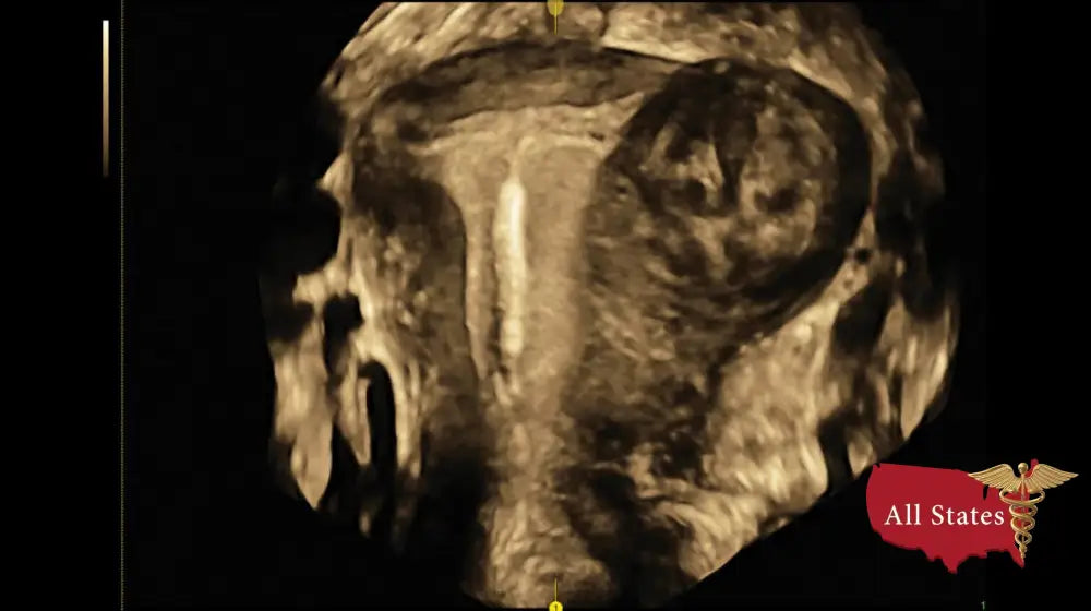 GE VOLUSON E8 Refurbished WITH 3 Probes