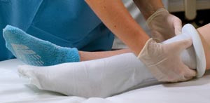 Albahealth, Llc Alba Sterile Double-Ply Stockinette