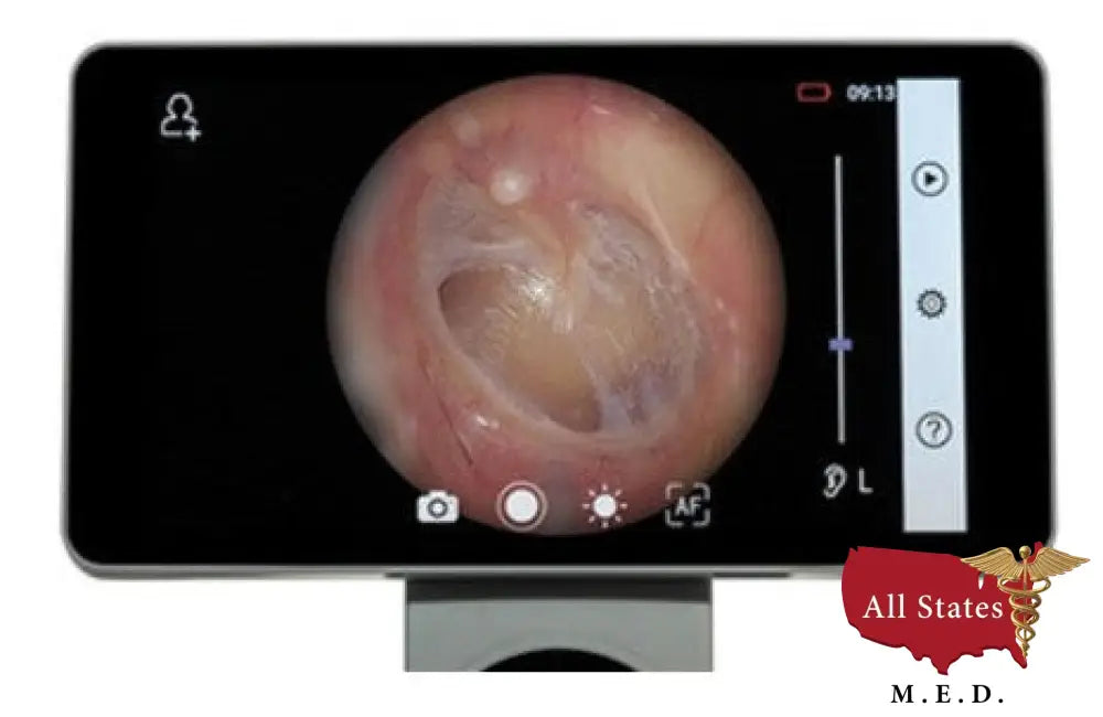 RCS-100 Camera Set. Includes RCS-100 camera, imaging, dermatoscope, and otoscope lenses