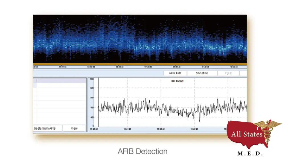 Edan SE 2003 / 2012 Holter monitor