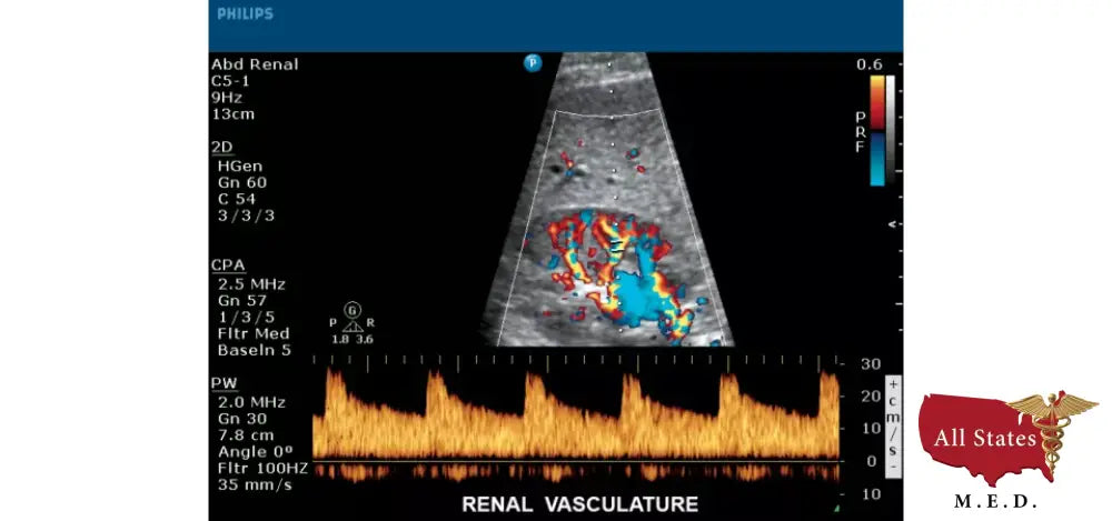 Philips CX50 Refurbished with 3 Probes