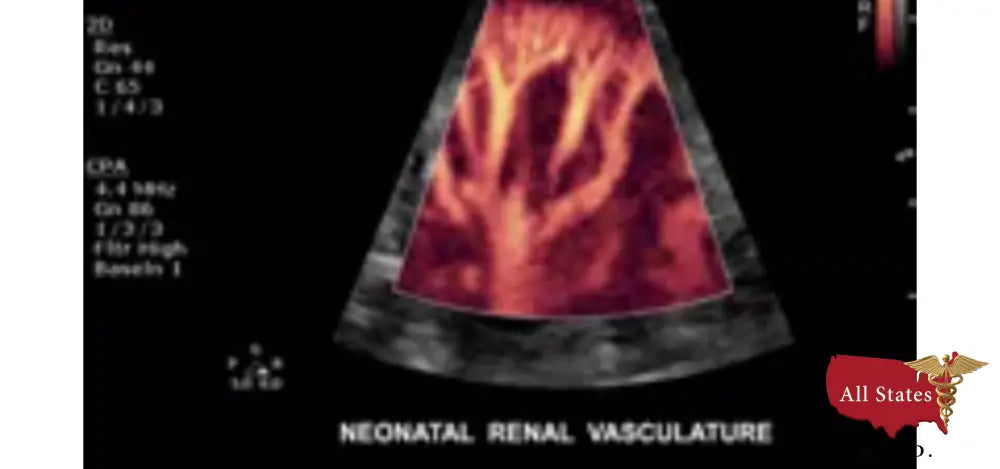 Philips CX50 Refurbished with 3 Probes